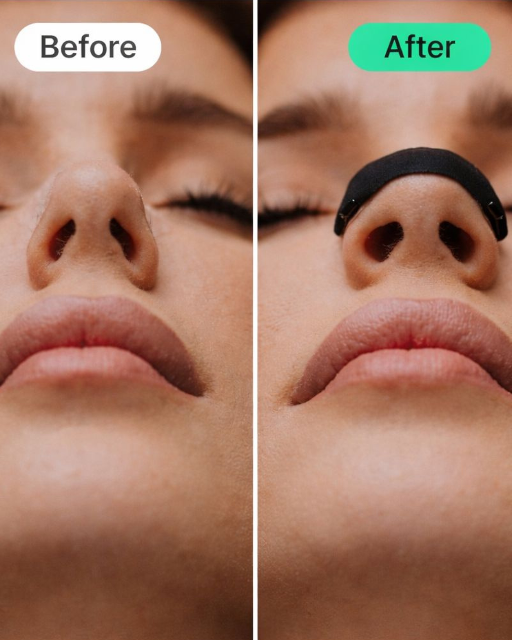 Breathing Nasal Strip Starter Kit